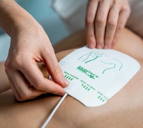 Electrozi Defibrilare Copii