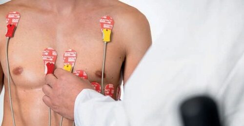 Electrozi EKG de Repaus