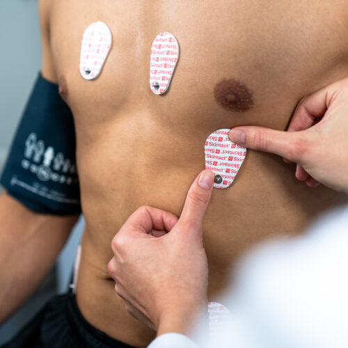 Stres Test si Holter Poza 1
