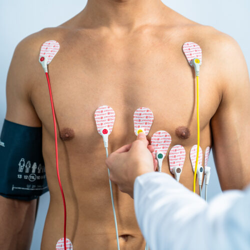 Stres Test si Holter Poza 2