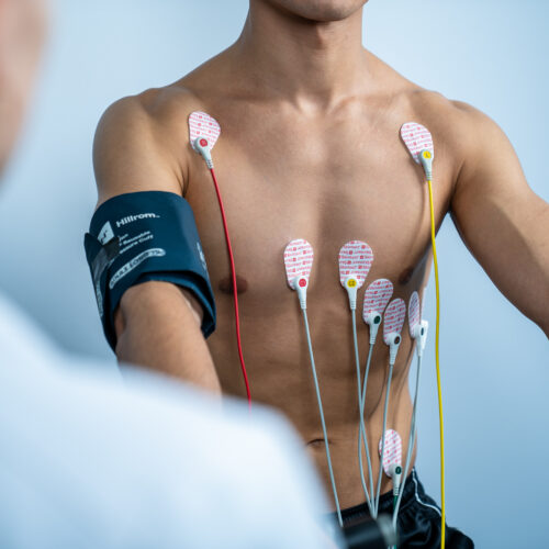 Stres Test si Holter Poza 3