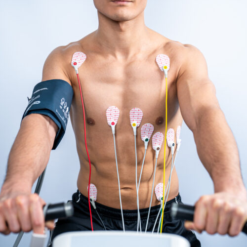 Stres Test si Holter Poza 4